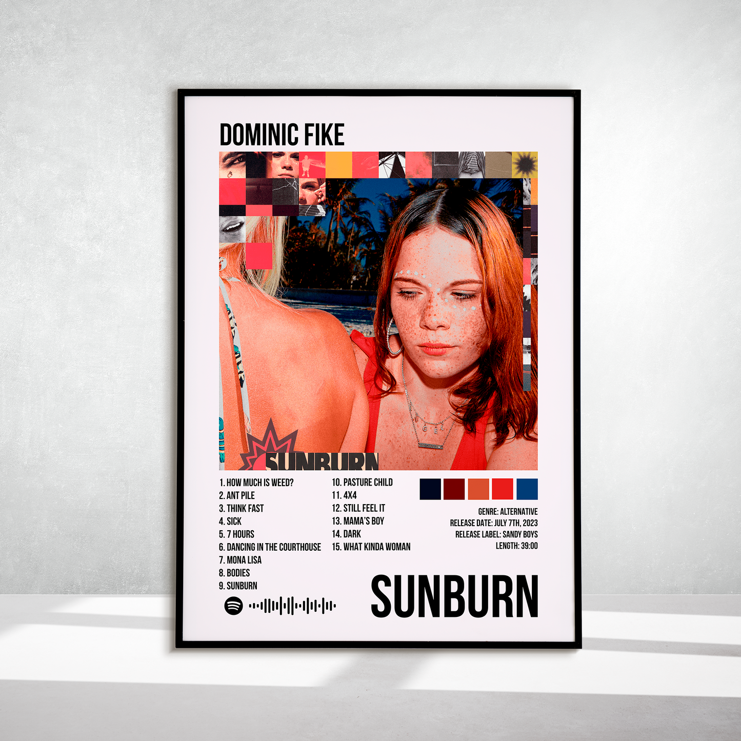 Sunburn