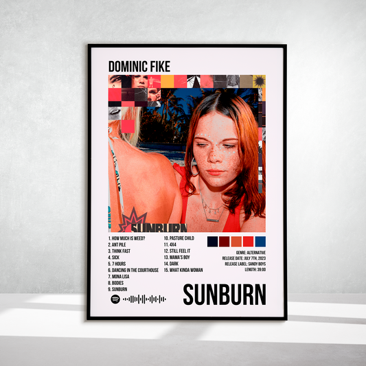 Sunburn